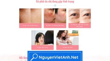 NVA0106 - Mỹ phẩm làm trắng - N072005